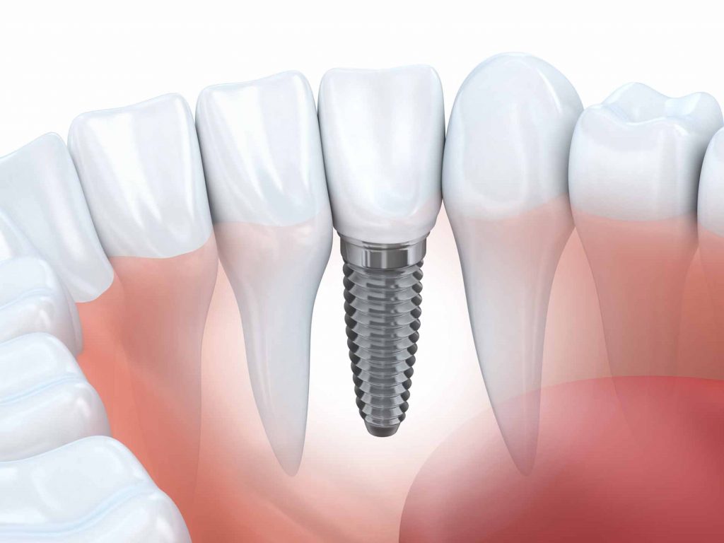 Dental Services